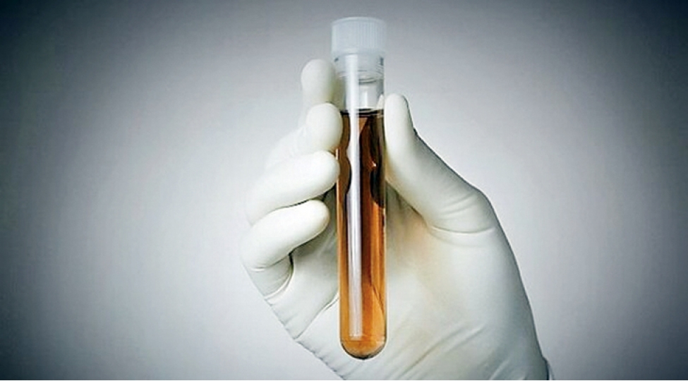 dunyanin-en-bahali-bir-litr-mayesi