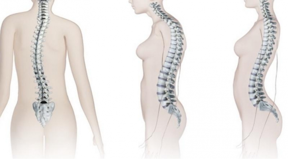 qarni-eriden-beli-duzleshdiren-sade-meshq-vdeo