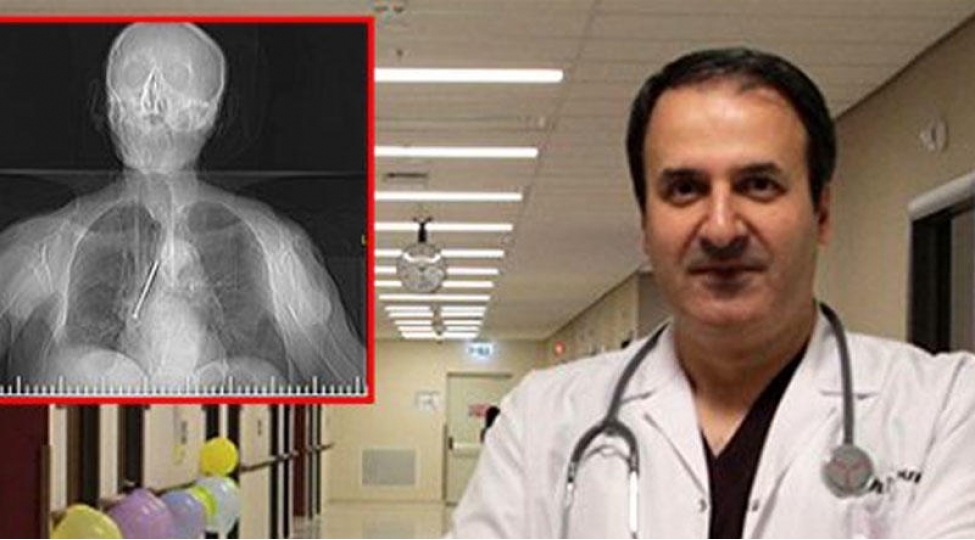 91-yashli-kishinin-agciyerinden-chixan-gorenleri-dehshete-getirir-video-foto