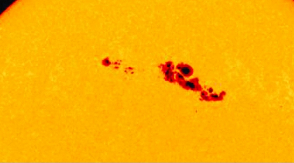 gunesh-lekelerinin-sirri-tapildi