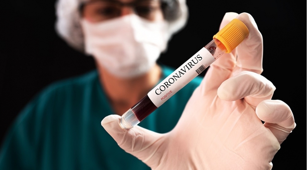 rusiyali-alimler-koronavirusun-tebii-mensheli-oldugunu-achiqladi