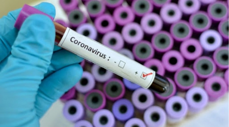 Dünyada koronavirusa yoluxanların sayı 7 milyonu keçdi