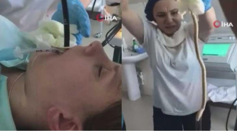 ilan-qadinin-agzindan-medesine-daxil-olub-video