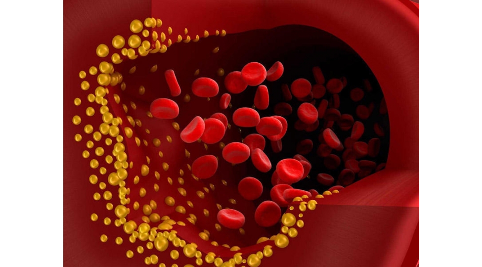 alimler-xolesterini-nece-azaltmagin-yolunu-tapiblar