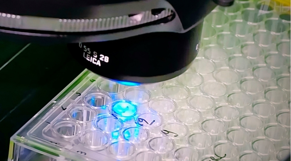 yaponiyali-hekim-koronavirusu-yungul-kechirenler-daha-chox-fesadla-qarshilashirlar