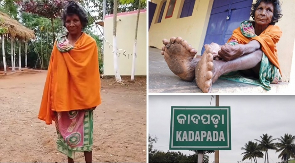 31-barmaqli-hindistanli-qadinin-aci-taleyi-foto