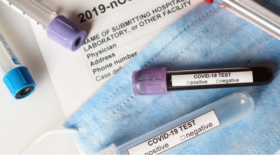 klublarimizin-koronavirus-testlerinin-neticesi-achiqlandi