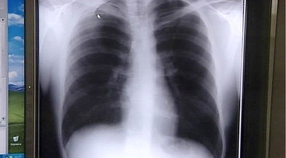 agciyer-xerchenginin-gozle-gorunen-elameti