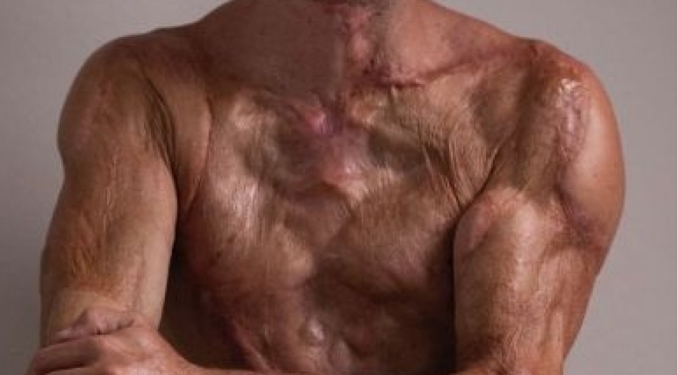 14-min-voltluq-elektrik-vurdu-sag-qaldi