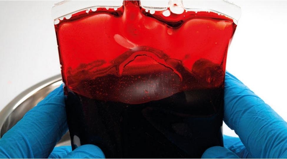 siqaret-chekenler-qan-donoru-ola-bilermi