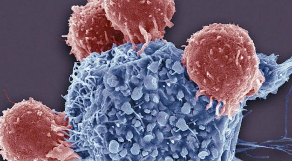 xerchengin-universal-simptomlari