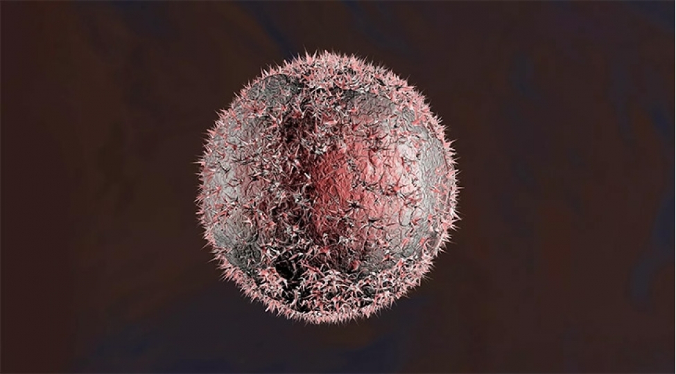 hezmin-pozulmasi-olumcul-bir-xesteliyin-elameti-ola-biler