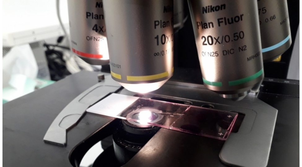 covid-19-un-ashkar-edilmesi-uchun-yeni-test-hazirlanib