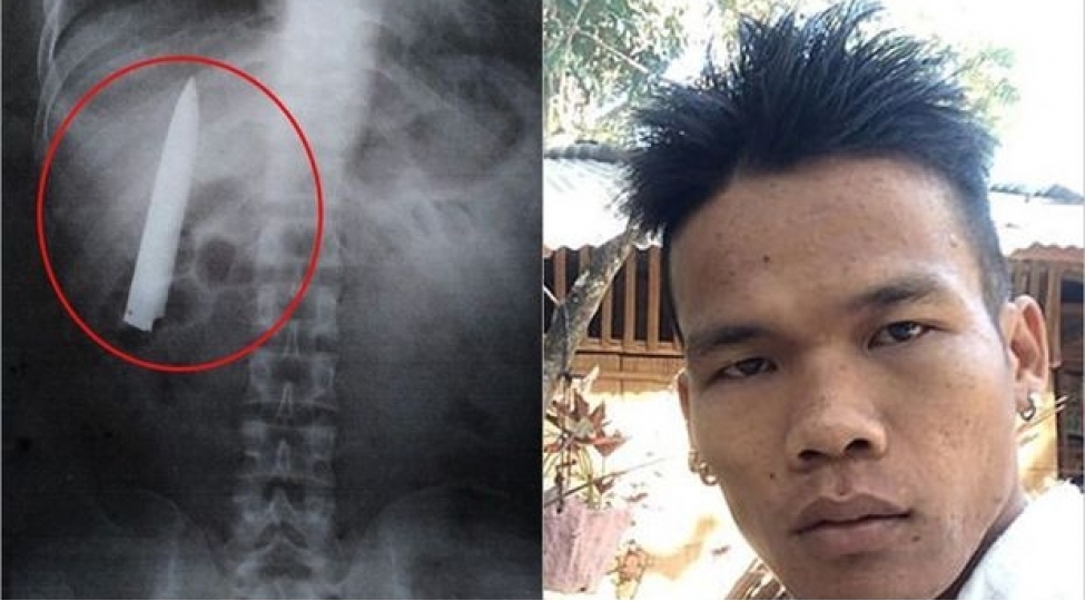 sinesine-saplanan-bichaqdan-bir-il-xeberi-olmadi