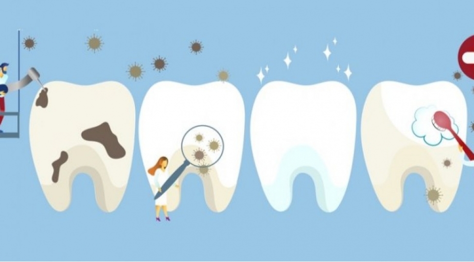 stomatologiya-ile-bagli-maraqli-faktlar-foto