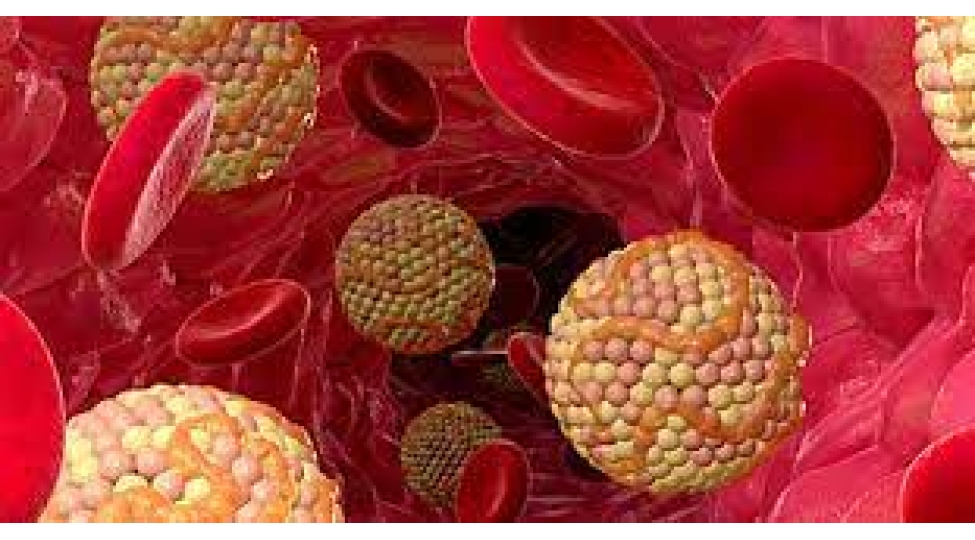 qanda-xolesterol-artiqligini-gosteren-yegane-elamet