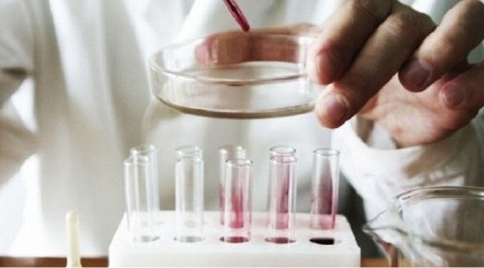 azerbaycanda-bu-laborator-analizler-pulsuzdur-siyahi