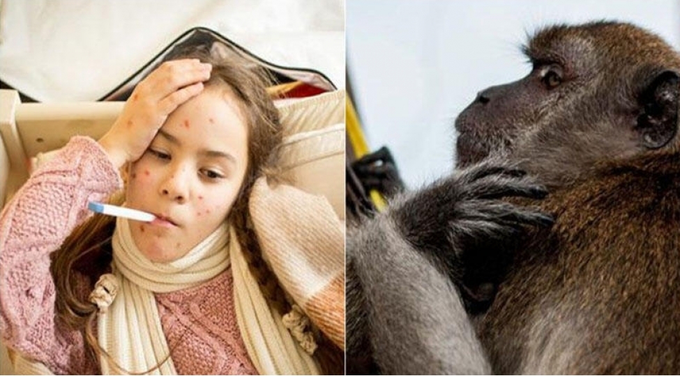 dunyada-yeni-tehlukeli-pandemiya-gozlenilir-meymunlardan-kechecek