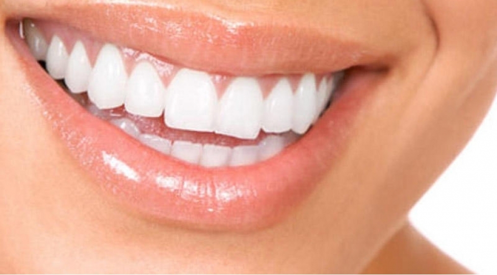 dishleri-saglam-saxlamaq-uchun-vasiteler