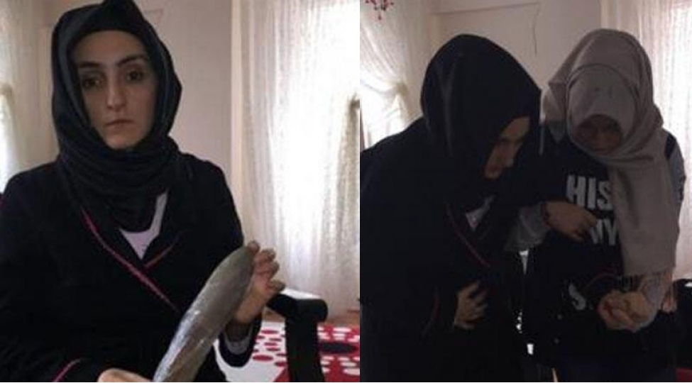 cerrah-malani-xestenin-qarninda-unutdu-foto