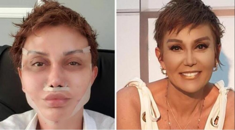 estetik-etdirdi-menim-neyim-eskikdir