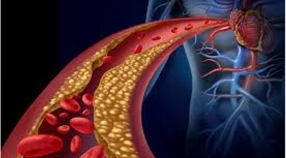 pis-xolesteroldan-dermansiz-da-qurtulmaq-olar