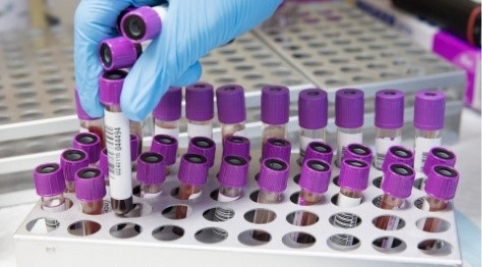 covid-19-kechirdikden-sonra-hansi-analizleri-vermeli