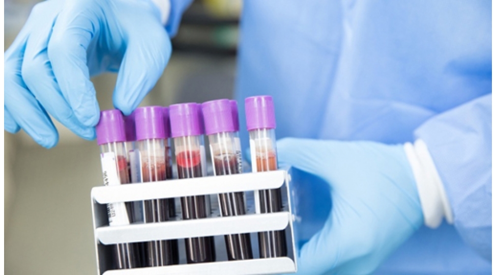 koronavirusdan-sonra-mutleq-bu-orqani-yoxlatdirin