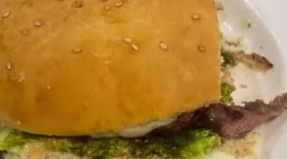 etcheken-mashinda-iki-barmagi-qaldi-xeberi-olmadi-hamburgerden-chixdi-video