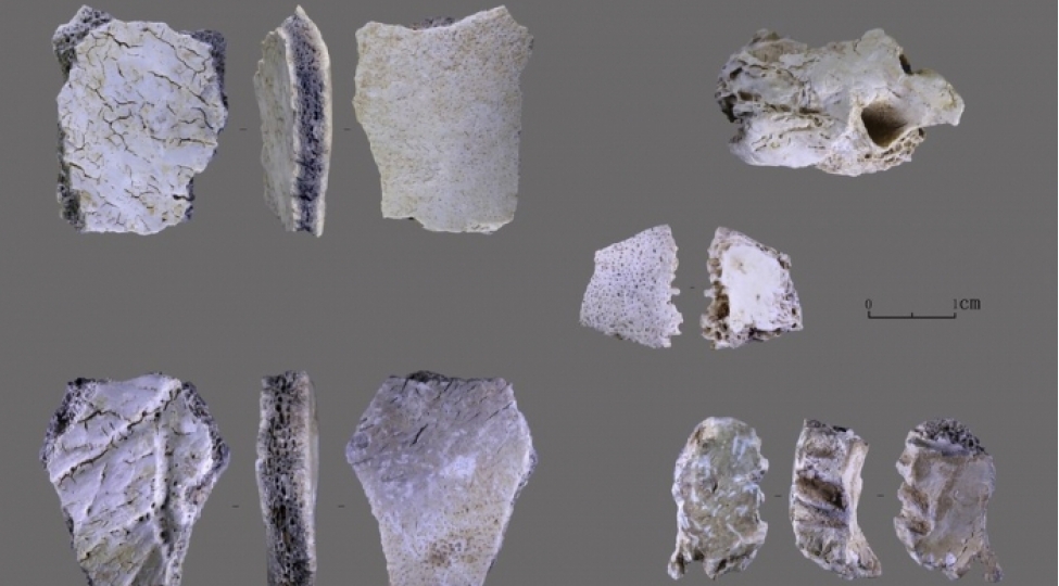 32-min-il-yashi-olan-insan-sumuyu-tapilib