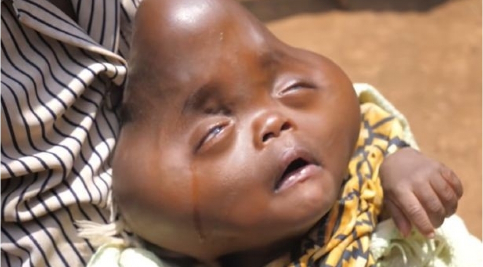 choxushaqli-ana-bashi-armudu-xatirladan-ushaq-dunyaya-getirib-foto