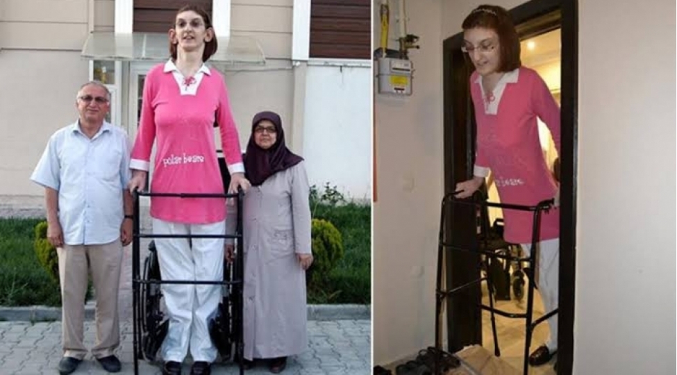 turkiyeli-rumeysa-gelgi-dunyanin-en-uzun-boylu-qadini-olaraq-ginnesin-rekordlar-kitabina-dushub