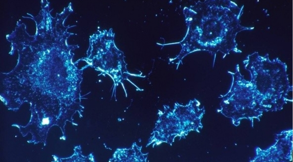 oksford-universitetinin-alimleri-xercheng-eleyhine-derman-hazirlayiblar