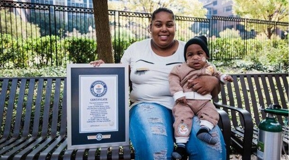 korpe-rekordlar-kitabina-dushdu-foto