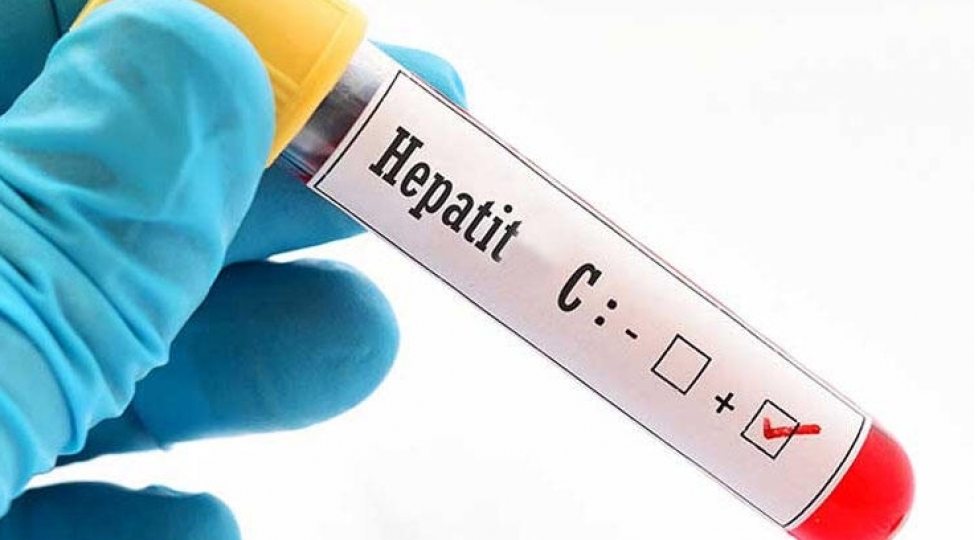 bu-mualice-kursu-xesteni-hepatit-c-den-tam-azad-edir
