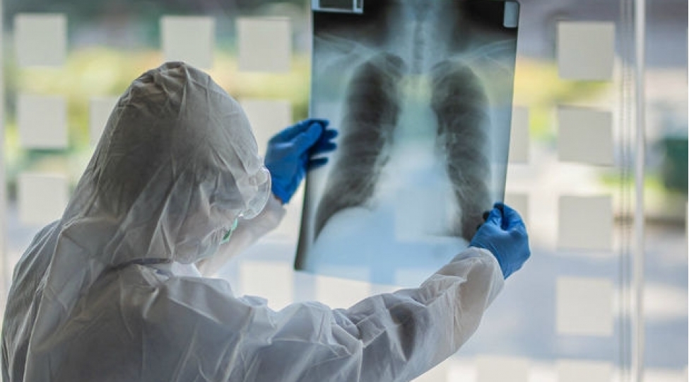 omikron-pnevmoniyaya-sebeb-olur