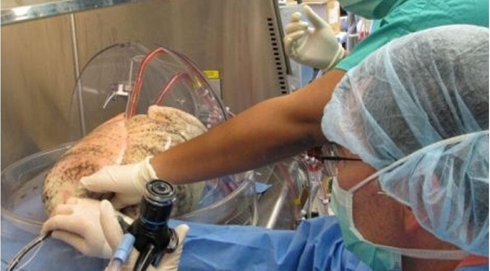 tibbde-ilk-universal-donor-agciyeri-yaradildi