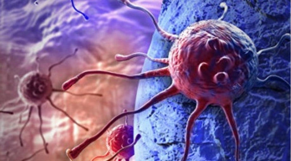 xerchengin-subut-olunmush-5-sebebi