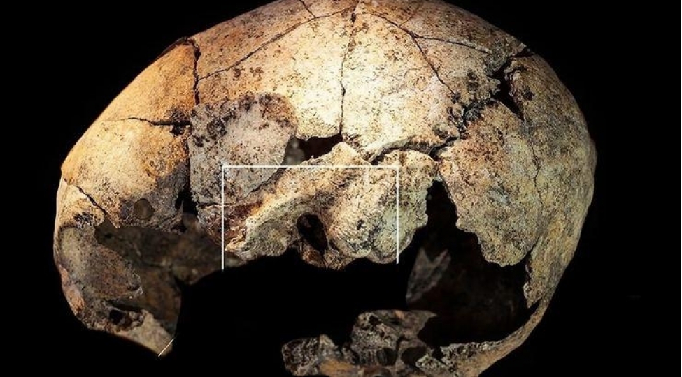 5300-illik-kellede-en-qedim-qulaq-emeliyyatinin-izleri-tapilib-foto