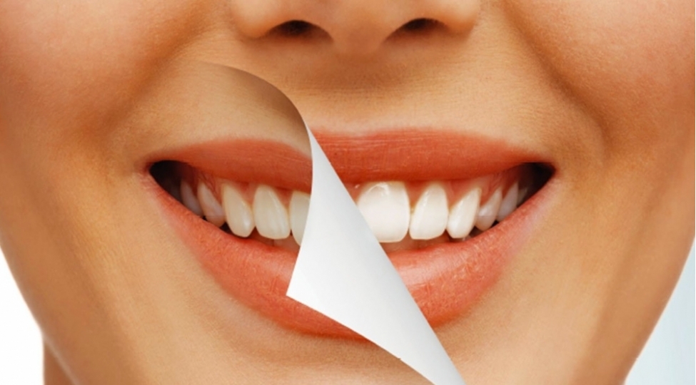 beyaz-dishlere-sahib-olmaq-uchun-bunu-edin