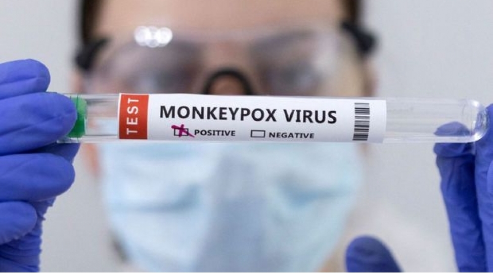 meymunchicheyi-virusunun-adi-deyishdirilir