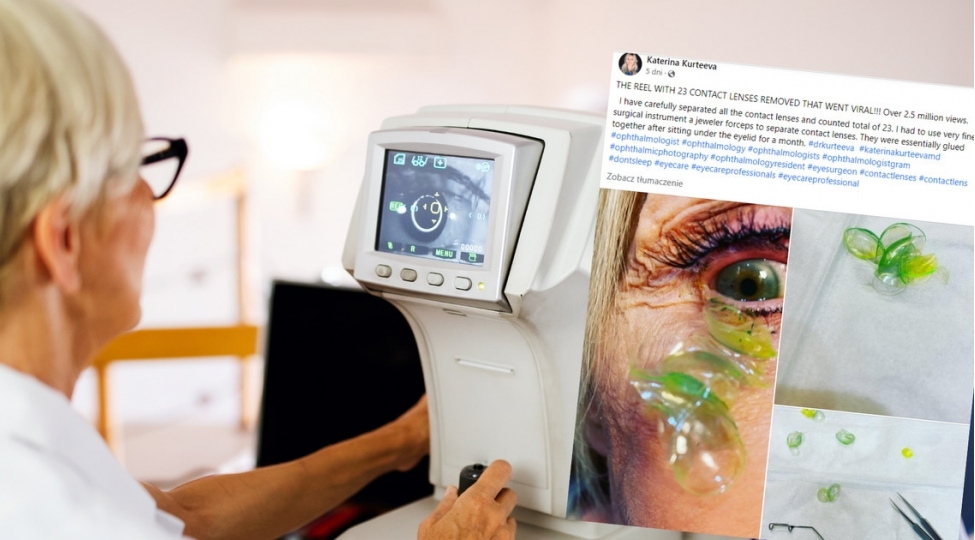 xestenin-gozunden-23-ededfoto