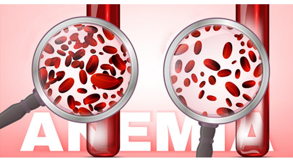 anemiyanin-sebebleri