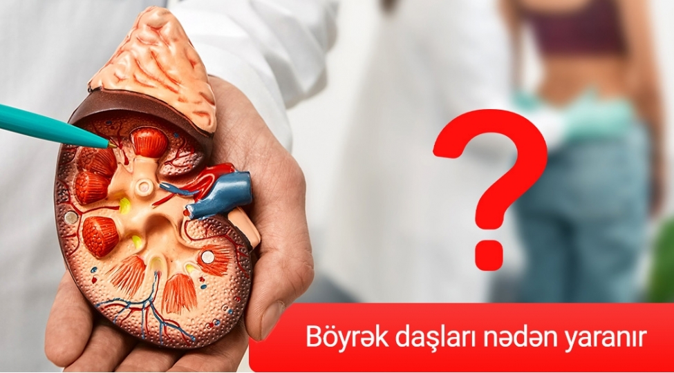 insana-en-keskin-agrini-yashadan-boyrek-dashlari-neden-yaranir