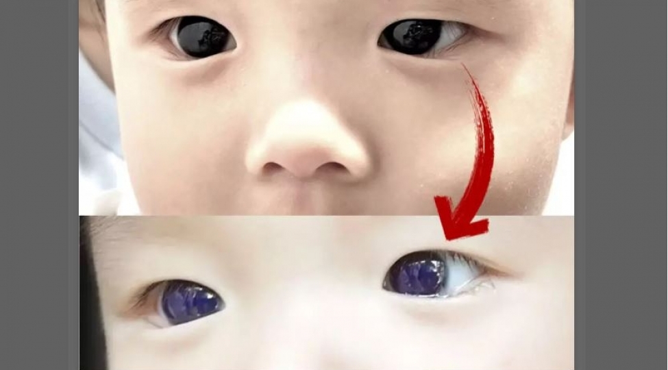 qehveyi-gozleri-maviye-chevrildi-sebeb-bu-dermandir