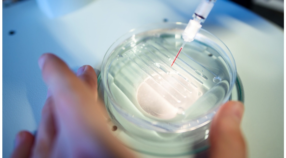 xercheng-yoluxucu-deyil-ancaq-ona-da-virus-sebeb-ola-biler-bioloq