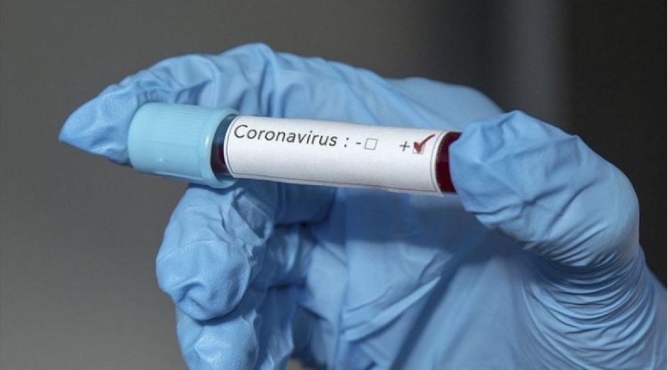 olkemizde-daha-76-nefer-koronavirusa-yoluxdu