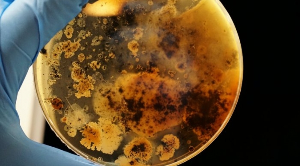 mikrob-bakteriya-ve-ya-virus