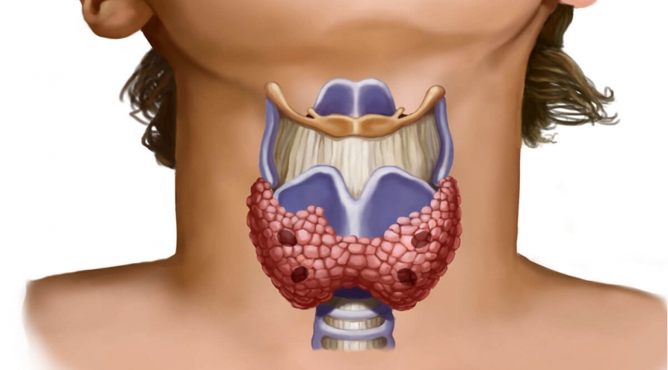 azyashlilarda-zeherli-zob-ustunluk-teshkil-edir