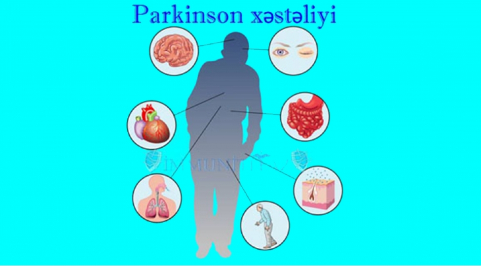 parkinson-xesteliyi-gelecekde-mualice-oluna-biler